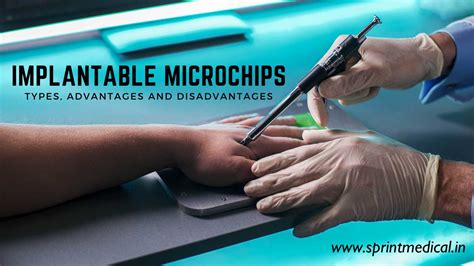 implanted rfid chip|Microchips in humans: consumer.